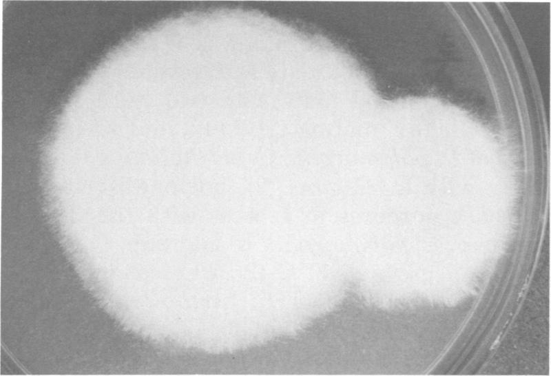 https://cdn.ncbi.nlm.nih.gov/pmc/blobs/2b05/273172/9ace3c0fa865/jcm00182-0133-b.jpg