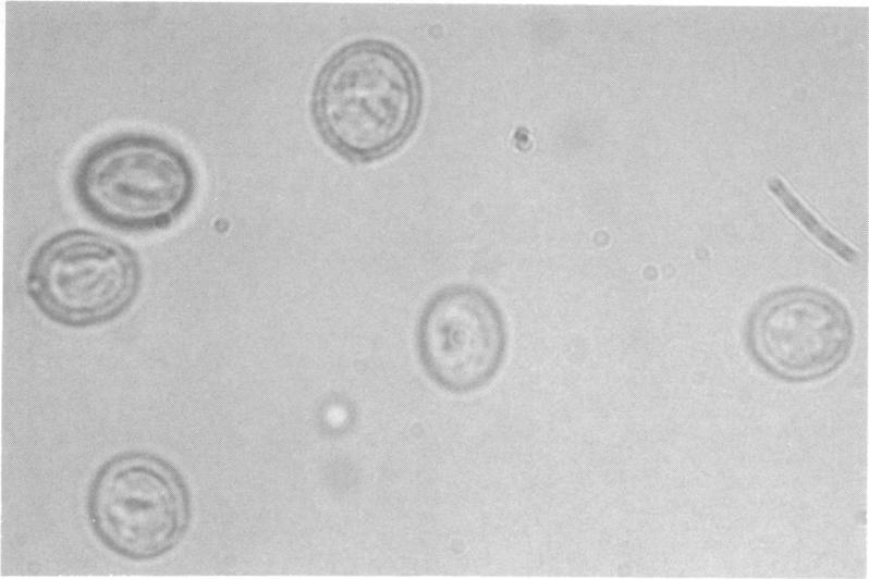 https://cdn.ncbi.nlm.nih.gov/pmc/blobs/2b05/273172/e84f7af6eb39/jcm00182-0134-b.jpg