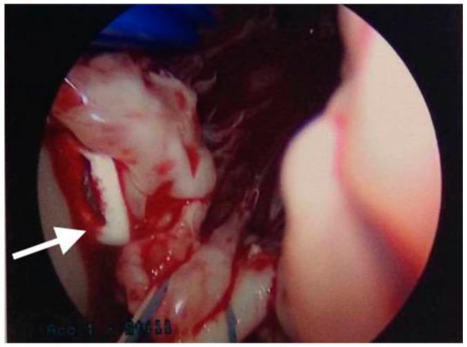 https://cdn.ncbi.nlm.nih.gov/pmc/blobs/2b05/5456584/26d603492f5b/materials-09-00821-g003.jpg