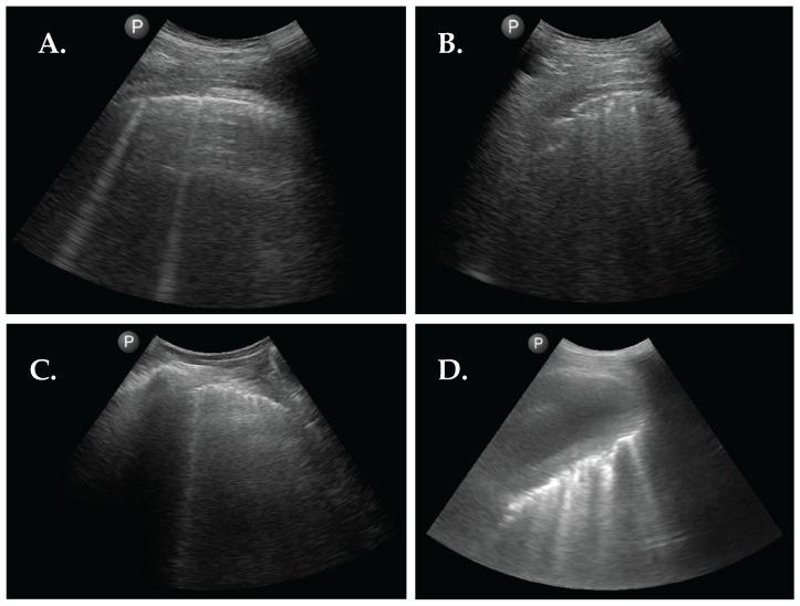 https://cdn.ncbi.nlm.nih.gov/pmc/blobs/2b06/10529908/c55da58878bf/diagnostics-13-02986-g002.jpg