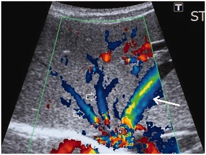 https://cdn.ncbi.nlm.nih.gov/pmc/blobs/2b07/6563404/78f512519f9f/10.1177_2058460119854173-fig3.jpg