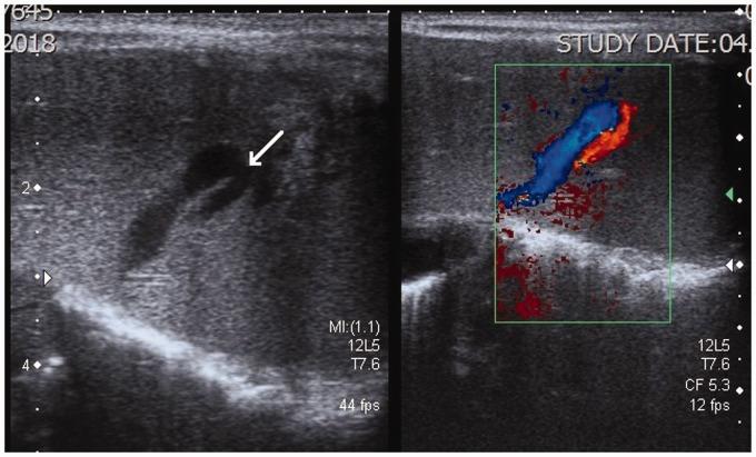 https://cdn.ncbi.nlm.nih.gov/pmc/blobs/2b07/6563404/f530b234abc7/10.1177_2058460119854173-fig2.jpg
