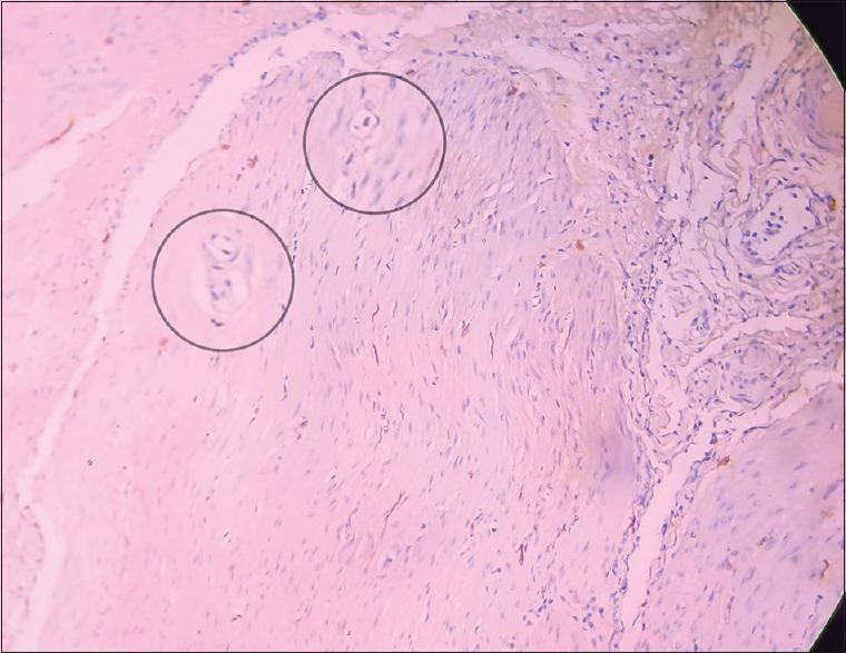 https://cdn.ncbi.nlm.nih.gov/pmc/blobs/2b09/11832098/50dc7270d893/JIAPS-30-22-g003.jpg