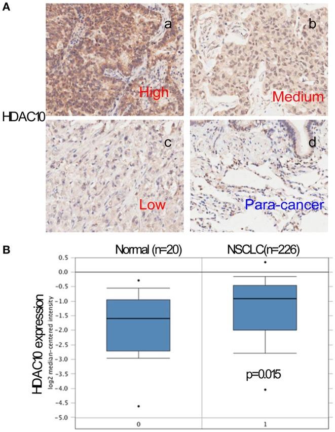 https://cdn.ncbi.nlm.nih.gov/pmc/blobs/2b09/7186423/c01cb75041a5/fonc-10-00485-g0001.jpg