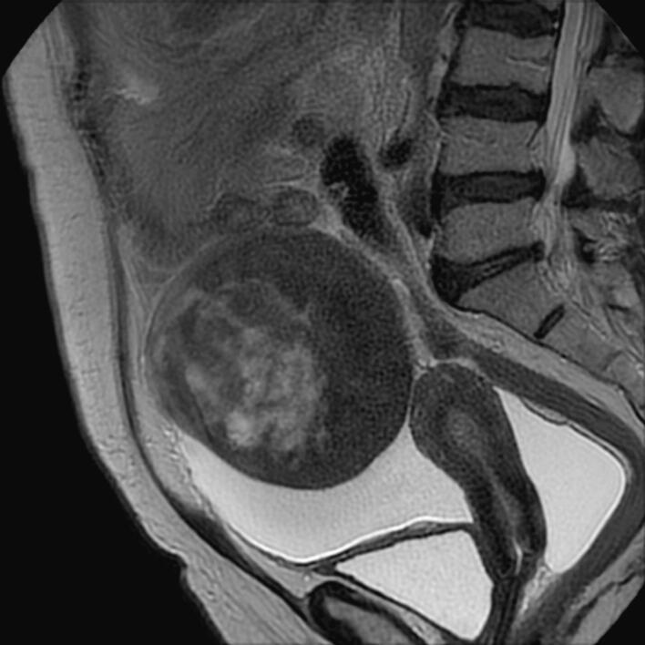 https://cdn.ncbi.nlm.nih.gov/pmc/blobs/2b16/10667754/2fe6dac3ba1b/gr1.jpg