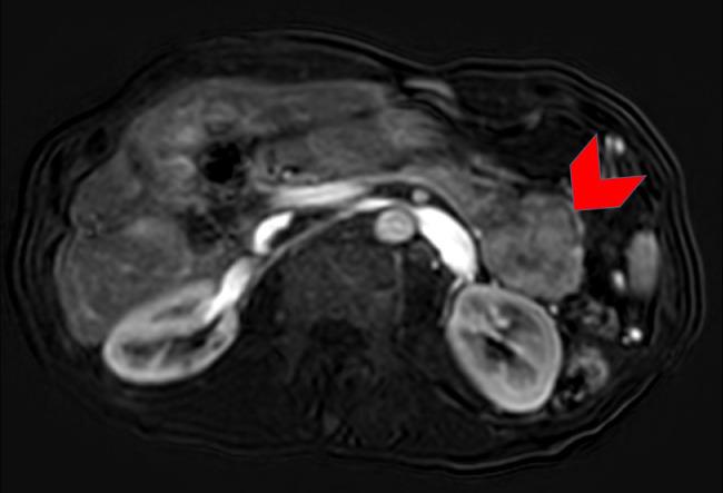 https://cdn.ncbi.nlm.nih.gov/pmc/blobs/2b18/6849422/1a5b5640fd30/gr5.jpg