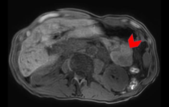 https://cdn.ncbi.nlm.nih.gov/pmc/blobs/2b18/6849422/1ab6724a52ba/gr7.jpg