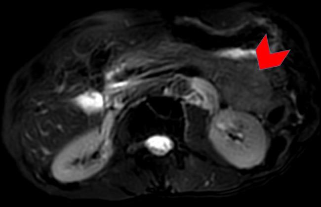 https://cdn.ncbi.nlm.nih.gov/pmc/blobs/2b18/6849422/9f9620d10ef1/gr3.jpg