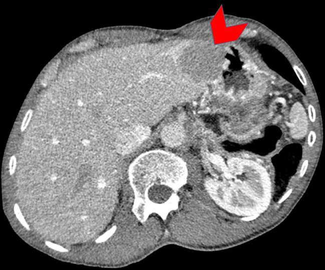 https://cdn.ncbi.nlm.nih.gov/pmc/blobs/2b18/6849422/c45243f62fd1/gr2.jpg