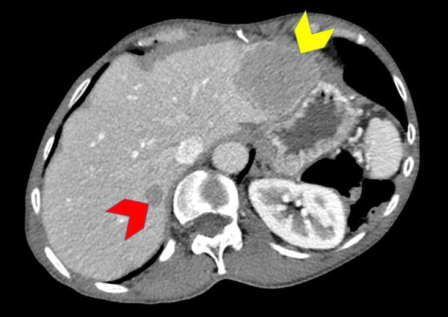 https://cdn.ncbi.nlm.nih.gov/pmc/blobs/2b18/6849422/f9964f571d43/gr6.jpg