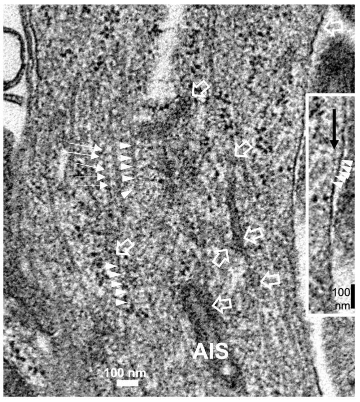https://cdn.ncbi.nlm.nih.gov/pmc/blobs/2b1b/10671465/615a4f66b4f9/ijms-24-16448-g009.jpg