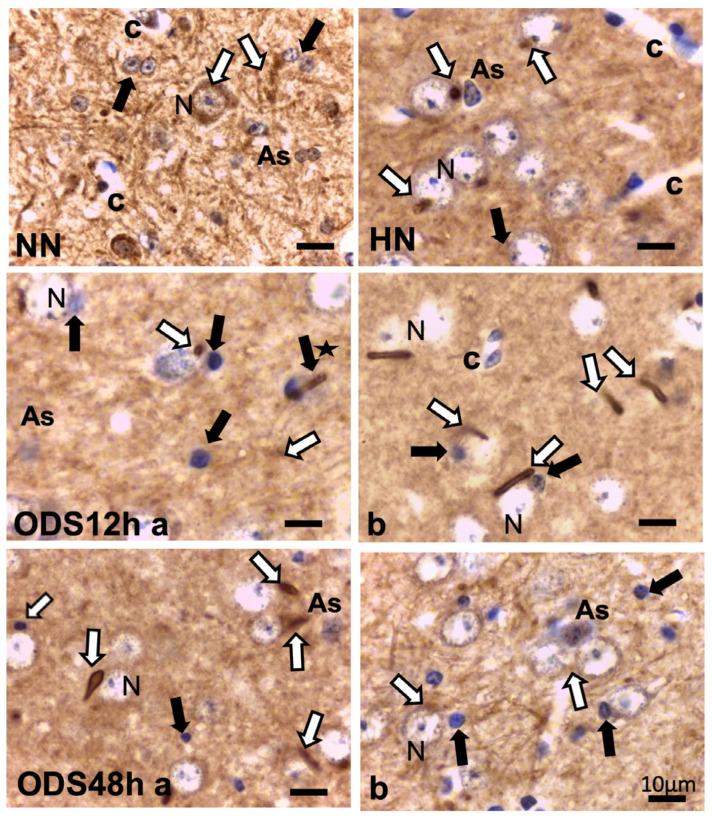 https://cdn.ncbi.nlm.nih.gov/pmc/blobs/2b1b/10671465/7fb7171da8ad/ijms-24-16448-g004.jpg