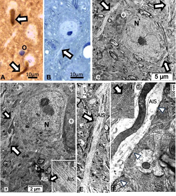 https://cdn.ncbi.nlm.nih.gov/pmc/blobs/2b1b/10671465/d0ed84ffeec5/ijms-24-16448-g014.jpg