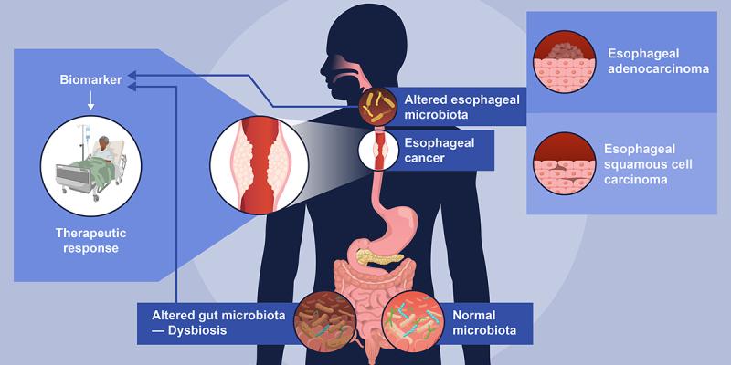 https://cdn.ncbi.nlm.nih.gov/pmc/blobs/2b1b/12087659/df7a60d337fb/KGMI_A_2505118_UF0001_OC.jpg