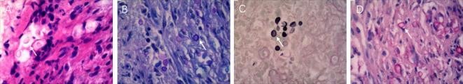 https://cdn.ncbi.nlm.nih.gov/pmc/blobs/2b24/10634414/dfa13986d002/fcimb-13-1258021-g003.jpg