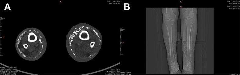 https://cdn.ncbi.nlm.nih.gov/pmc/blobs/2b2c/9477477/479b57adea17/jvb-21-e20210166-g04.jpg