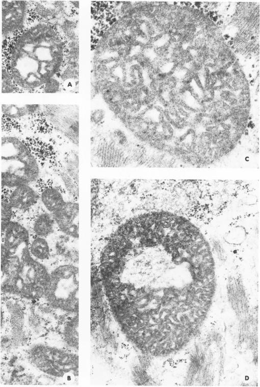 https://cdn.ncbi.nlm.nih.gov/pmc/blobs/2b2e/2042326/a23471d58522/amjpathol00243-0099-a.jpg