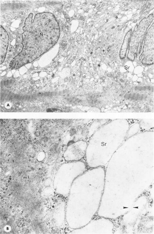https://cdn.ncbi.nlm.nih.gov/pmc/blobs/2b2e/2042326/f6492ba7ee03/amjpathol00243-0098-a.jpg