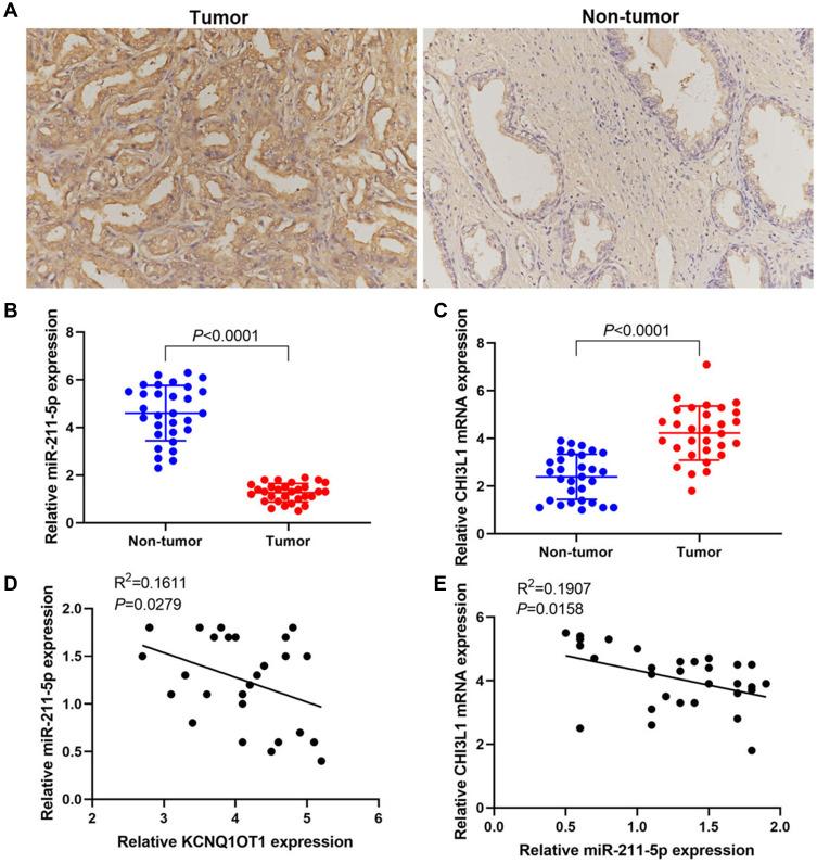 https://cdn.ncbi.nlm.nih.gov/pmc/blobs/2b2f/7937373/3bc44d25c5b9/OTT-14-1659-g0006.jpg