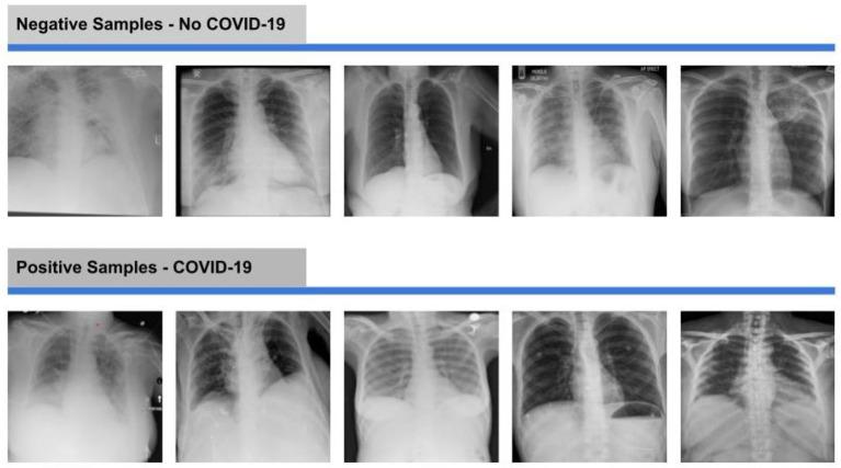 https://cdn.ncbi.nlm.nih.gov/pmc/blobs/2b41/10009152/9fc6afb1a6db/fpubh-11-1025746-g0004.jpg