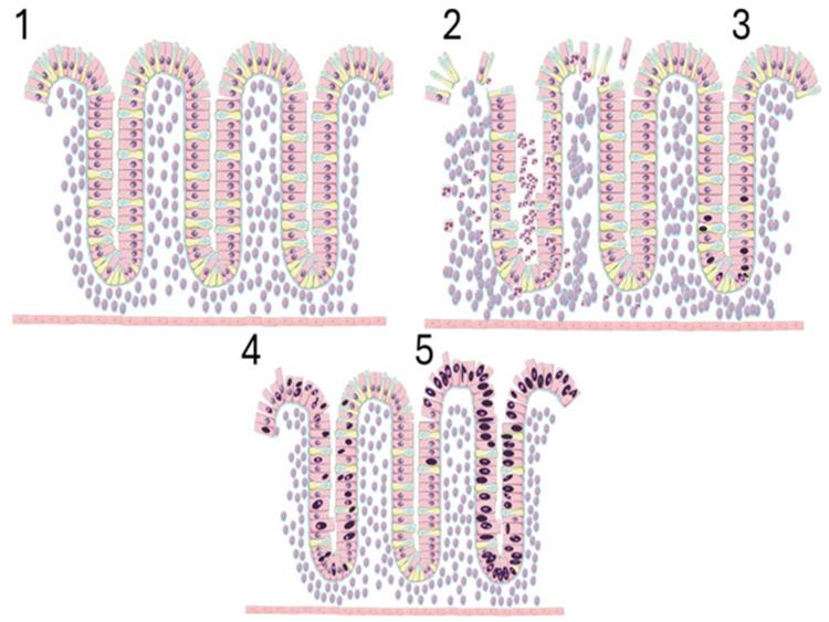 https://cdn.ncbi.nlm.nih.gov/pmc/blobs/2b42/11817687/c4ebed160cc1/cells-14-00162-g001.jpg