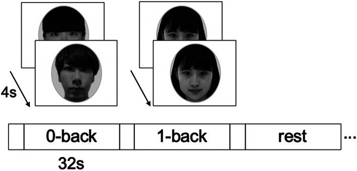 https://cdn.ncbi.nlm.nih.gov/pmc/blobs/2b48/7927292/a0427e0a8496/HBM-42-1359-g002.jpg