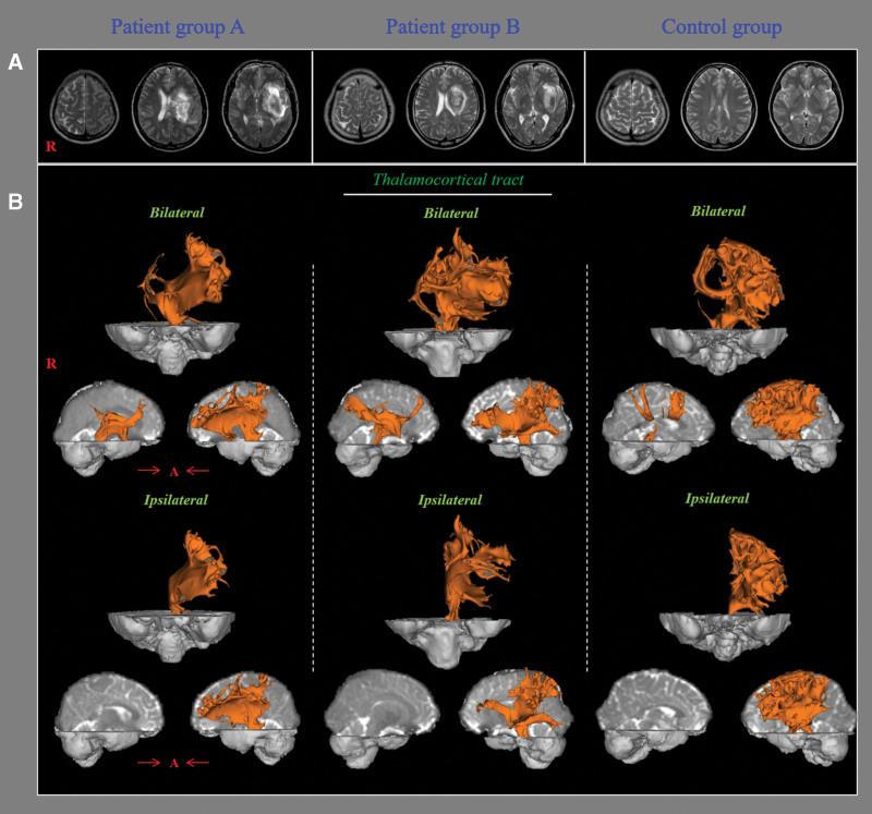 https://cdn.ncbi.nlm.nih.gov/pmc/blobs/2b4f/10578689/004218fc3a17/medi-102-e35510-g001.jpg