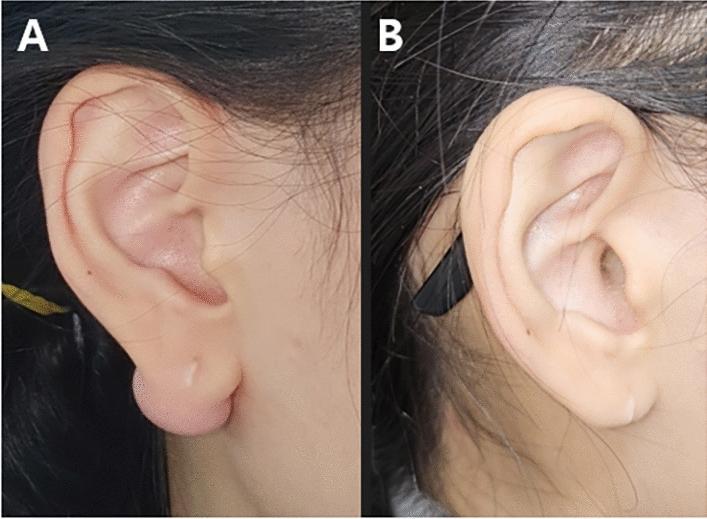 https://cdn.ncbi.nlm.nih.gov/pmc/blobs/2b52/11814004/45815d0d4283/266_2024_4433_Fig2_HTML.jpg