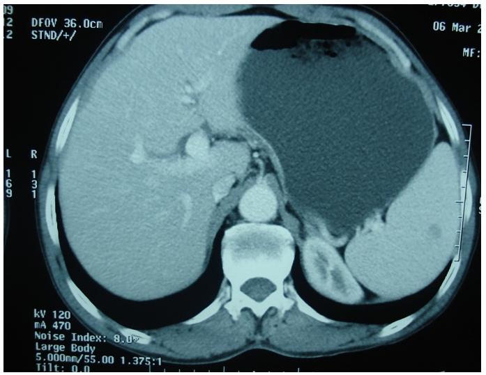 https://cdn.ncbi.nlm.nih.gov/pmc/blobs/2b54/3290874/9c6e0db270f5/PAMJ-10-44-g001.jpg