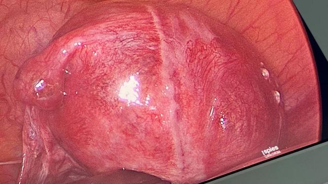 https://cdn.ncbi.nlm.nih.gov/pmc/blobs/2b56/11129747/15ef1db55407/IJWH-16-917-g0004.jpg