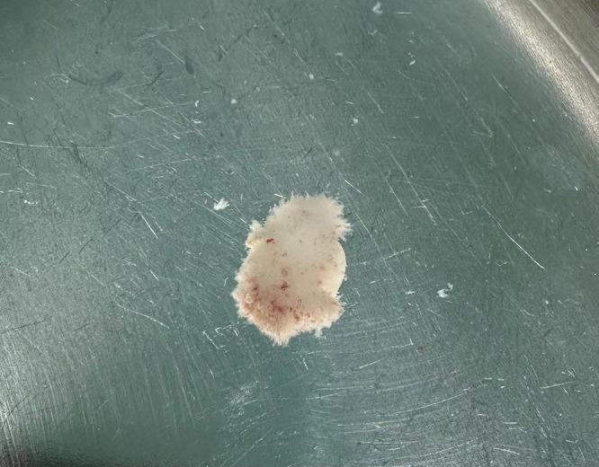 https://cdn.ncbi.nlm.nih.gov/pmc/blobs/2b56/11129747/183cf67ecdb6/IJWH-16-917-g0006.jpg