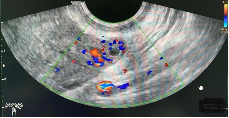 https://cdn.ncbi.nlm.nih.gov/pmc/blobs/2b56/11129747/d832c01138c2/IJWH-16-917-g0003.jpg