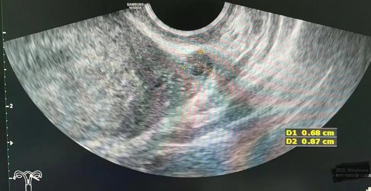 https://cdn.ncbi.nlm.nih.gov/pmc/blobs/2b56/11129747/dcf34b3e0e64/IJWH-16-917-g0001.jpg