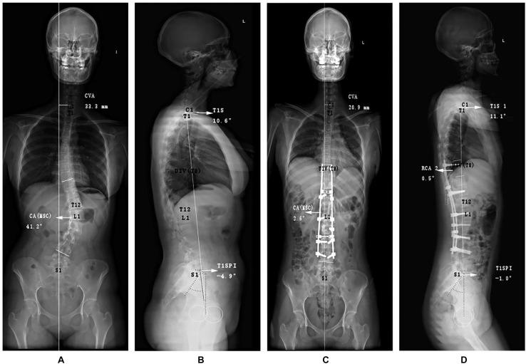 https://cdn.ncbi.nlm.nih.gov/pmc/blobs/2b56/7573316/b5911461aac7/fbioe-08-559387-g002.jpg