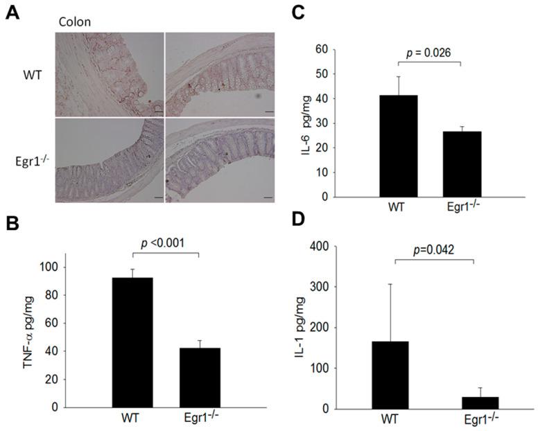 https://cdn.ncbi.nlm.nih.gov/pmc/blobs/2b57/11047900/b310b4e6e610/biomedicines-12-00780-g003.jpg