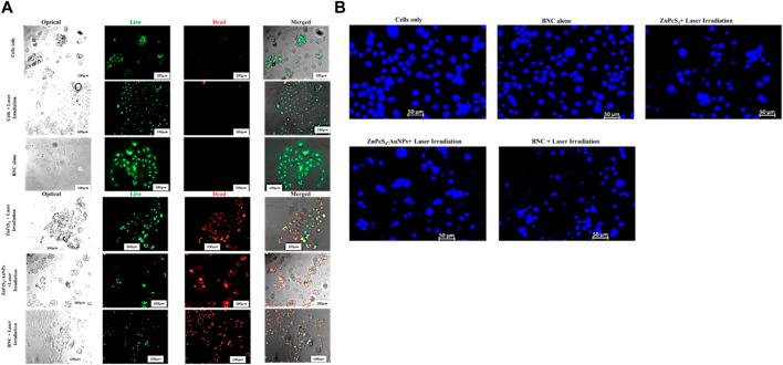 https://cdn.ncbi.nlm.nih.gov/pmc/blobs/2b5a/10801020/261b12b349ab/fmolb-10-1340212-g014.jpg