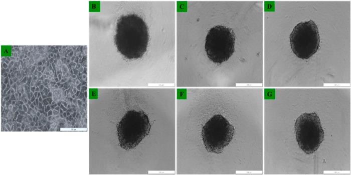 https://cdn.ncbi.nlm.nih.gov/pmc/blobs/2b5a/10801020/e1d352f4fb75/fmolb-10-1340212-g007.jpg