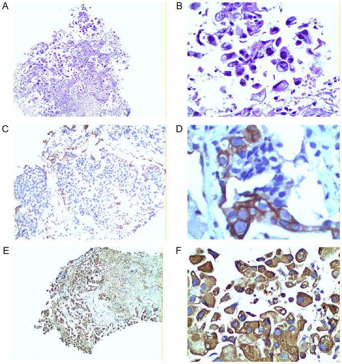 https://cdn.ncbi.nlm.nih.gov/pmc/blobs/2b5a/7412726/50d8c460bd03/ol-20-04-11898-g01.jpg