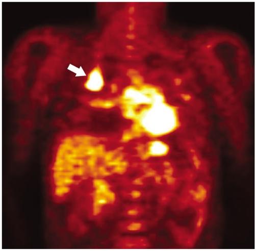 https://cdn.ncbi.nlm.nih.gov/pmc/blobs/2b5b/2667579/04cac7dea7fb/kjr-7-57-g011.jpg