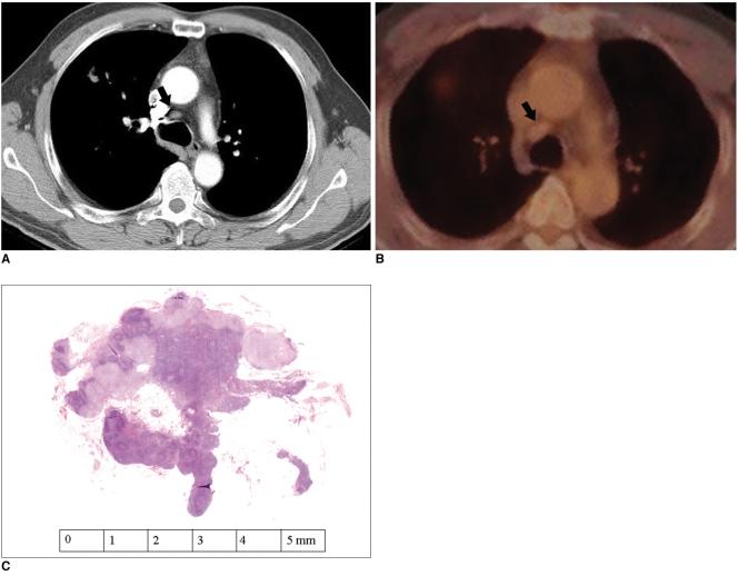https://cdn.ncbi.nlm.nih.gov/pmc/blobs/2b5b/2667579/0555864691e7/kjr-7-57-g015.jpg