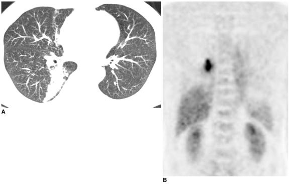 https://cdn.ncbi.nlm.nih.gov/pmc/blobs/2b5b/2667579/0ecc27edd252/kjr-7-57-g007.jpg
