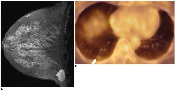 https://cdn.ncbi.nlm.nih.gov/pmc/blobs/2b5b/2667579/2d520ac77611/kjr-7-57-g016.jpg