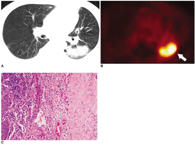 https://cdn.ncbi.nlm.nih.gov/pmc/blobs/2b5b/2667579/c2429b43405b/kjr-7-57-g010.jpg