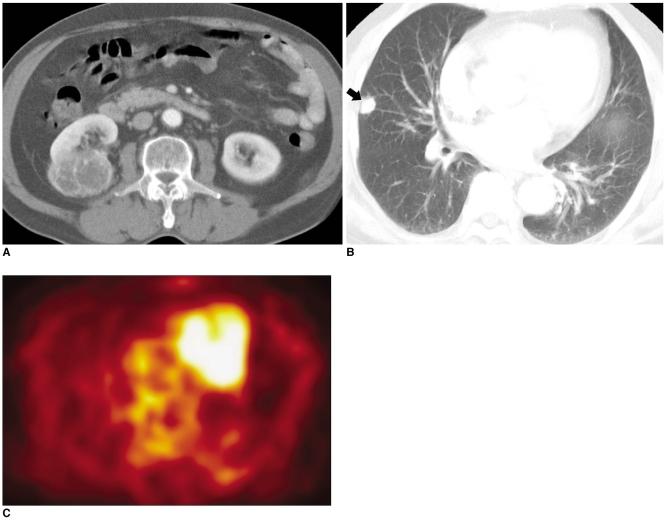 https://cdn.ncbi.nlm.nih.gov/pmc/blobs/2b5b/2667579/d8cfe44f7cc0/kjr-7-57-g017.jpg