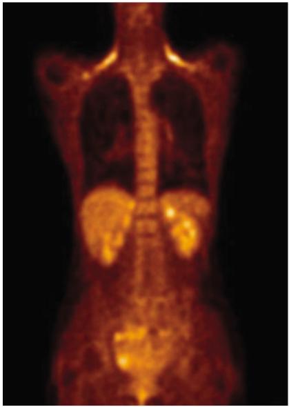 https://cdn.ncbi.nlm.nih.gov/pmc/blobs/2b5b/2667579/fa3aa96c02f9/kjr-7-57-g002.jpg