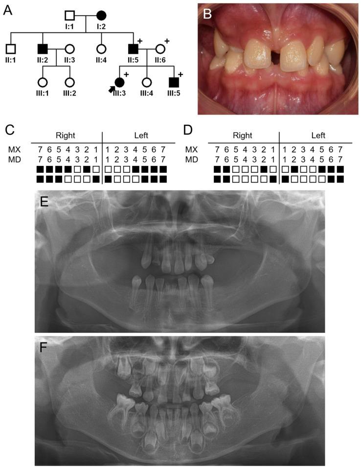 https://cdn.ncbi.nlm.nih.gov/pmc/blobs/2b5f/10890363/6941ecef4203/jpm-14-00191-g001.jpg