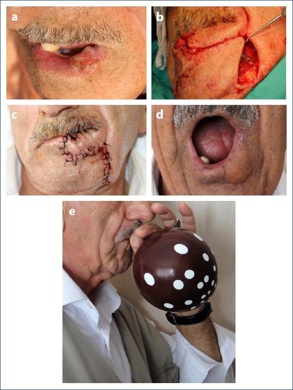 https://cdn.ncbi.nlm.nih.gov/pmc/blobs/2b60/7192271/d4912aadf47a/MBSEH-53-256-g003.jpg
