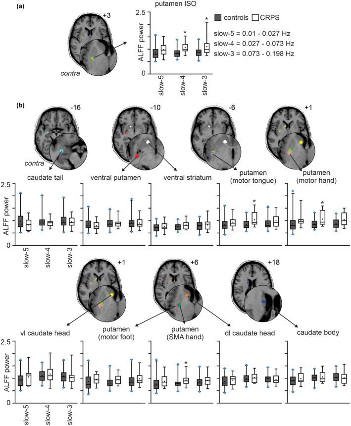 https://cdn.ncbi.nlm.nih.gov/pmc/blobs/2b70/9543905/3de997befd14/JNR-100-1487-g004.jpg