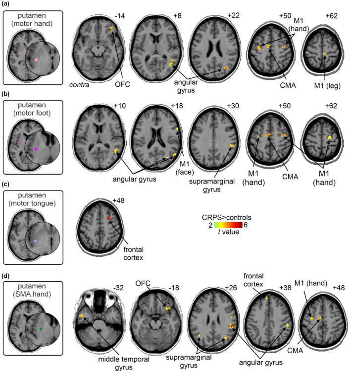 https://cdn.ncbi.nlm.nih.gov/pmc/blobs/2b70/9543905/5955000429d3/JNR-100-1487-g002.jpg