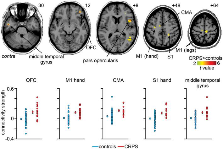 https://cdn.ncbi.nlm.nih.gov/pmc/blobs/2b70/9543905/aeeb61706818/JNR-100-1487-g005.jpg